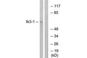 Western blot analysis of extracts from LOVO cells, using Ik3-1 Antibody. (CABLES1 Antikörper  (AA 561-610))