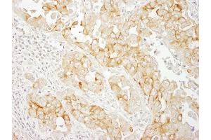 anti-Notch 2 (NOTCH2) (AA 2421-2471) antibody