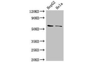 Western Blot Positive WB detected in: HepG2 whole cell lysate, Hela whole cell lysate All lanes: CDT1 antibody at 3 μg/mL Secondary Goat polyclonal to rabbit IgG at 1/50000 dilution Predicted band size: 61 kDa Observed band size: 61 kDa (CDT1 Antikörper  (AA 12-170))