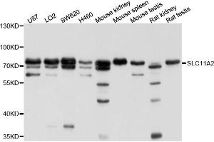Western blot analysis of extracts of various cell lines, using SLC11A2 antibody (ABIN4905173) at 1:1000 dilution. (SLC11A2 Antikörper)