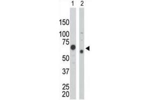 Western Blotting (WB) image for anti-Pyruvate Kinase (PK) antibody (ABIN2995247) (Pyruvate Kinase Antikörper)