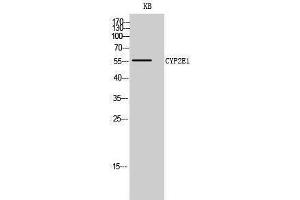 Western Blotting (WB) image for anti-Cytochrome P450, Family 2, Subfamily E, Polypeptide 1 (CYP2E1) (C-Term) antibody (ABIN3174658) (CYP2E1 Antikörper  (C-Term))
