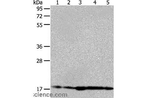 Western blot analysis of Hela and 293T cell, mouse liver tissue, A431 and MCF-7 cell, using ARF6 Polyclonal Antibody at dilution of 1:450 (ARF6 Antikörper)