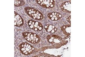Immunohistochemical staining of human colon with KIF25 polyclonal antibody  shows strong cytoplasmic positivity in glandular cells. (KIF25 Antikörper)