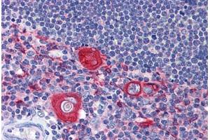 Human Thymus: Formalin-Fixed, Paraffin-Embedded (FFPE) (SNAPIN Antikörper  (AA 41-137))