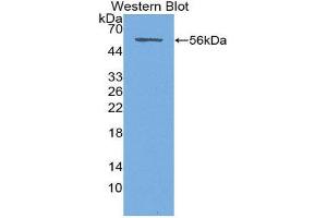Western Blotting (WB) image for anti-Syndecan 1 (SDC1) (AA 23-253) antibody (ABIN1870669) (Syndecan 1 Antikörper  (AA 23-253))