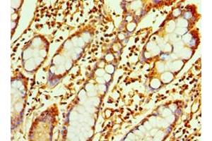 Immunohistochemistry of paraffin-embedded human small intestine tissue using ABIN7167347 at dilution of 1:100 (Rab4 Antikörper  (AA 1-218))