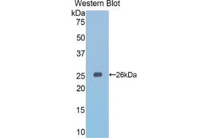 Western blot analysis of the recombinant protein. (SLIT3 Antikörper  (AA 1348-1517))