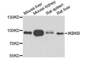 Western blot analysis of extracts of various cell lines, using IKBKB antibody. (IKBKB Antikörper  (AA 517-756))