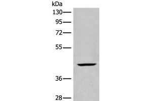 Western blot analysis of Human kidney tissue lysate using BBOX1 Polyclonal Antibody at dilution of 1:650 (BBOX1 Antikörper)