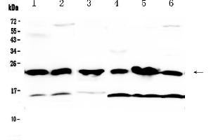 Western blot analysis of GST3 / GST pi using anti-GST3 / GST pi antibody .