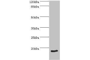 Western blot analysis of HeLa whole cell lysate, using NT-proBNP antibody (2 μg/ml).