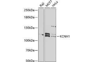 Western Blotting (WB) image for anti-Potassium Voltage-Gated Channel, Subfamily H (Eag-Related), Member 1 (KCNH1) (AA 813-962) antibody (ABIN6142711)