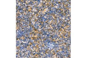 Immunohistochemistry of paraffin embedded rat lymph node using CD30 (ABIN7076073) at dilution of 1:600 (400x lens)