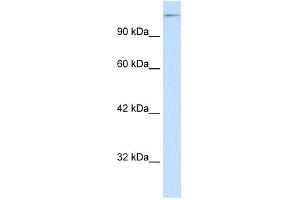 WB Suggested Anti-SUPT5H Antibody Titration: 0. (SUPT5H Antikörper  (C-Term))