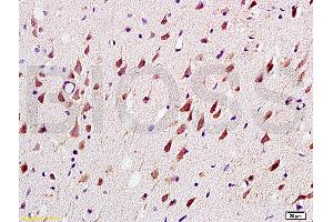 Formalin-fixed and paraffin embedded: rat brain tissue labeled with Anti-MAG-a/L-MAG Polyclonal Antibody (ABIN726935), Unconjugated at 1:200, followed by conjugation to the secondary antibody and DAB staining (MAG Antikörper  (AA 551-626))
