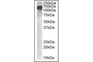 Image no. 1 for anti-ATP-Dependent RNA Helicase A (DHX9) (Internal Region) antibody (ABIN375159) (DHX9 Antikörper  (Internal Region))