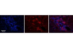 Rabbit Anti-C11orf24 Antibody      Formalin Fixed Paraffin Embedded Tissue: Human Adult Liver   Observed Staining: Membrane but only in connective tissue cells in the interlobular septum, very low tissue distribution  Primary Antibody Concentration: 1:100  Secondary Antibody: Donkey anti-Rabbit-Cy3  Secondary Antibody Concentration: 1:200  Magnification: 20X  Exposure Time: 0. (C11orf24 Antikörper  (N-Term))