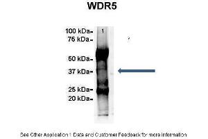 Amount and Sample Type :  500 ug Human NT2 cell lysate  Amount of IP Antibody :  6 ug  Primary Antibody :  WDR5  Primary Antibody Dilution :  1:500  Secondary Antibody :  Goat anti-rabbit Alexa-Fluor 594  Secondary Antibody Dilution :  1:5000  Gene Name :  WDR5  Submitted by :  Dr.