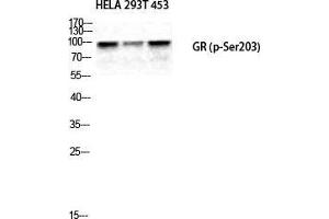 Western Blot (WB) analysis of HeLa 293T 453 cells using Phospho-GR (S203) Polyclonal Antibody. (GR (pSer203) Antikörper)