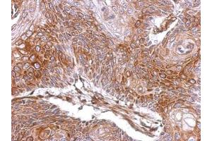 IHC-P Image Immunohistochemical analysis of paraffin-embedded Cal27 xenograft, using ELA3A, antibody at 1:500 dilution. (Elastase 3A Antikörper)