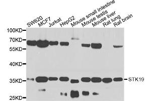 Western blot analysis of extracts of various cell lines, using STK19 antibody. (STK19 Antikörper)