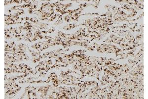 ABIN6268880 at 1/100 staining Human lung tissue by IHC-P. (FASL Antikörper  (Internal Region))