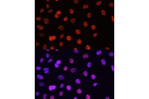 Immunofluorescence analysis of HeLa cells using Asymmetric DiMethyl-Histone H3-R17 antibody (ABIN3023282, ABIN3023283, ABIN3023284 and ABIN6219538) at dilution of 1:100. (Histone 3 Antikörper  (H3R17me))