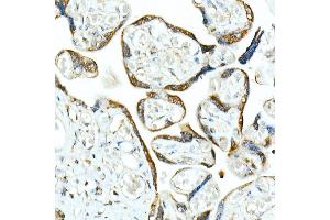 Immunohistochemistry of paraffin-embedded human placenta using Smad9 Rabbit pAb (ABIN6132668, ABIN6148096, ABIN6148097 and ABIN6223425) at dilution of 1:100 (40x lens). (SMAD9 Antikörper  (AA 1-300))