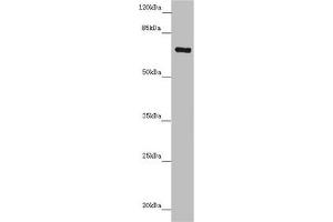 Western blot All lanes: ZNF169 antibody at 5. (ZNF169 Antikörper  (AA 1-85))