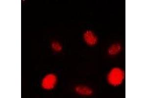 Immunofluorescent analysis of RAD54A staining in HEK293T cells. (RAD54L Antikörper)
