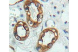 Used in DAB staining on fromalin fixed paraffin-embedded Kidney tissue (ALT Antikörper  (AA 290-533))