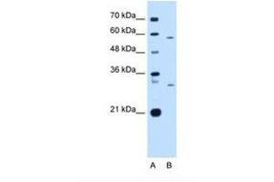 Image no. 2 for anti-CD36 (CD36) (N-Term) antibody (ABIN6738418)