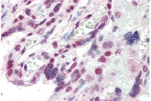 Human Placenta (formalin-fixed, paraffin-embedded) stained with CBX1 antibody ABIN337122 at 2. (CBX1 Antikörper  (AA 69-81))