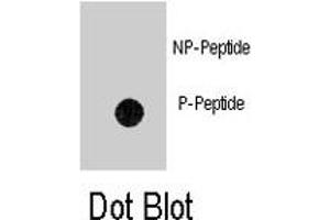 Dot blot analysis of ANTXR1 (phospho Y382) polyclonal antibody  on nitrocellulose membrane. (ANTXR1 Antikörper  (pTyr382))