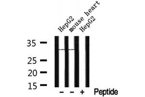 Western blot analysis of extracts from HepG2 and mouse heart, using CYB5R2 Antibody. (CYB5R2 Antikörper  (Internal Region))