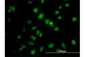 Immunofluorescence of purified MaxPab antibody to RBMS1 on HeLa cell. (RBMS1 Antikörper  (AA 1-406))