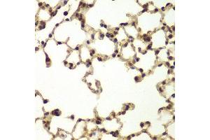 Immunohistochemistry (IHC) image for anti-DNA Repair Protein Complementing XP-B Cells (ERCC3) (AA 513-782) antibody (ABIN3022427) (ERCC3 Antikörper  (AA 513-782))