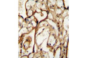 Immunohistochemistry (IHC) image for anti-Solute Carrier Family 3 (Activators of Dibasic and Neutral Amino Acid Transport), Member 2 (SLC3A2) antibody (ABIN2995541)