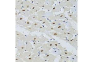 Immunohistochemistry of paraffin-embedded mouse heart using DDB1 Antibody. (DDB1 Antikörper)
