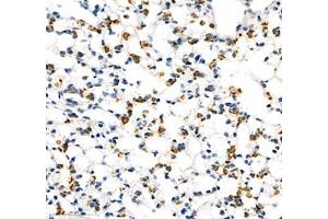 Immunohistochemistry (Paraffin-embedded Sections) (IHC (p)) image for anti-Adhesion Molecule with Ig-Like Domain 2 (AMIGO2) antibody (ABIN7072966)