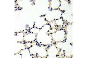 Immunohistochemistry of paraffin-embedded rat lung using PNKP antibody at dilution of 1:100 (x40 lens). (PNKP Antikörper)