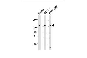 All lanes : Anti-TI Antibody (C-term) at 1:2000 dilution Lane 1: Ramos whole cell lysate Lane 2: HC whole cell lysate Lane 3: RI 8226 whole cell lysate Lysates/proteins at 20 μg per lane. (TIAM1 Antikörper  (C-Term))