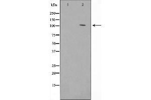 Western Blotting (WB) image for anti-Cadherin 1, Type 1, E-Cadherin (Epithelial) (CDH1) (C-Term) antibody (ABIN6261408)