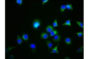 Immunofluorescence staining of A549 cells with ABIN7154549 at 1:44, counter-stained with DAPI.