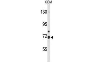 Western blot analysis of ALOX15B Antibody (C-term) in CEM cell line lysates (35µg/lane).