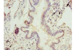 Immunohistochemistry of paraffin-embedded human lung tissue using ABIN7143016 at dilution of 1:100 (CHIA Antikörper  (AA 1-368))