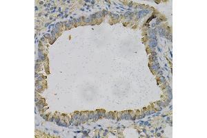 Immunohistochemistry of paraffin-embedded mouse lung using NEK2 Antibody (ABIN5973091) at dilution of 1/100 (40x lens).