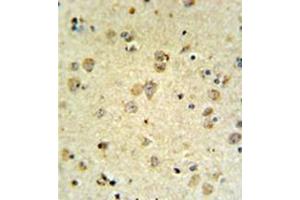 Immunohistochemistry analysis in formalin fixed and paraffin embedded brain tissue reacted with MAP4K3 Antibody , which was peroxidase conjugated to the secondary antibody and followed by DAB staining. (MAP4K3 Antikörper)