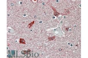 ABIN570984 (3. (CaMKII alpha/beta (Internal Region) Antikörper)